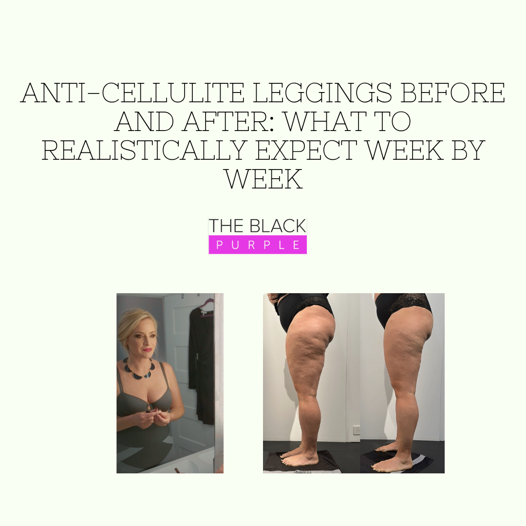 Anti-Cellulite Leggings Before and After - What to Realistically Expect Week by Week