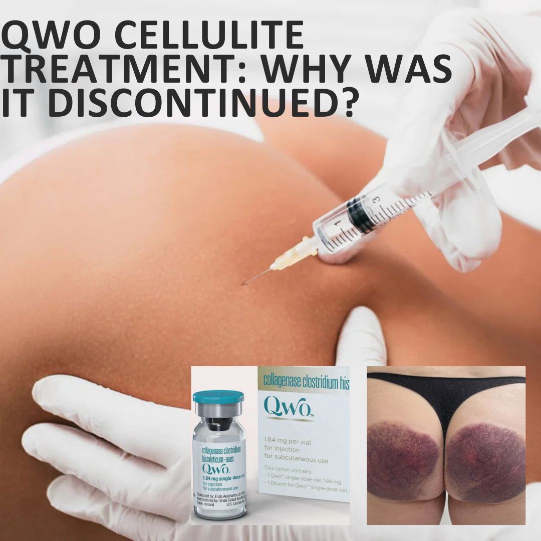 QWO Cellulite Treatment: Why Was It Discontinued?