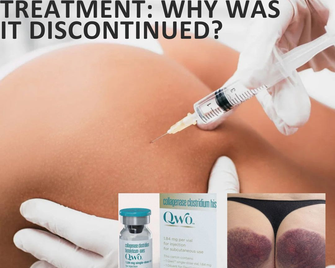 QWO Cellulite Treatment: Why Was It Discontinued?