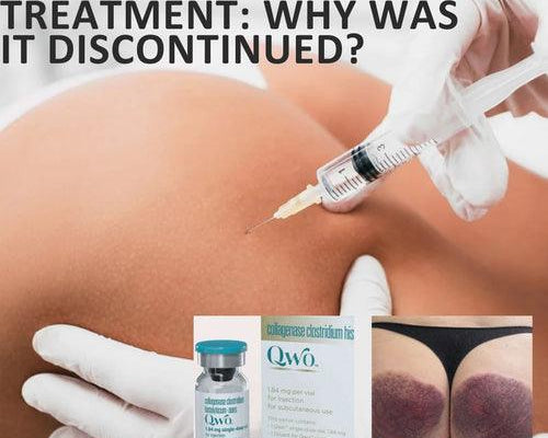 QWO Cellulite Treatment: Why Was It Discontinued?