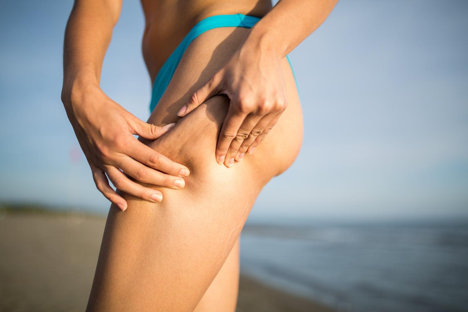 The Appearance of Cellulite Worsening in the Summer Sun | The Black Purple