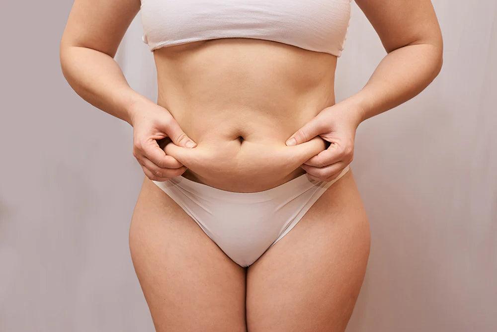 Why Do I Have Cellulite on My Stomach and Thighs?