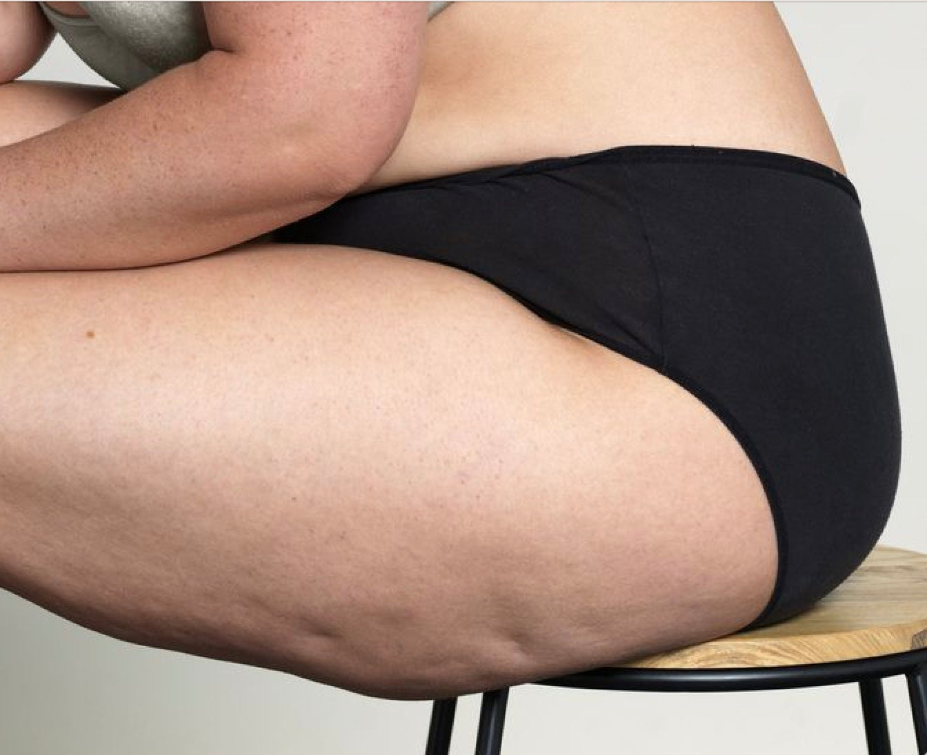 Why Do I Have Cellulite? Understanding the Causes and Solutions