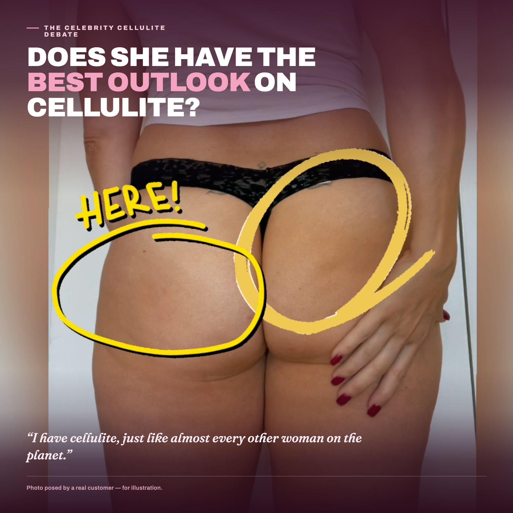 Rear view of a woman in black lace underwear with cellulite circled and labelled 'here,' beside the quote 'I have cellulite, just like almost every other woman on the planet' — cellulite acceptance blog cover.