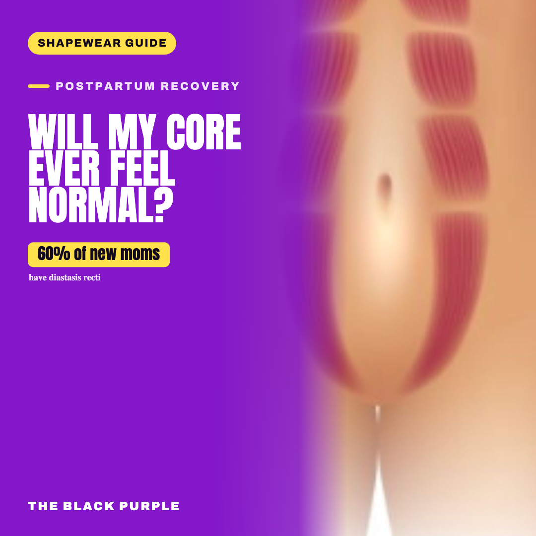 Anatomical diagram of abdominal muscles separating down the midline (diastasis recti) after pregnancy — TheBlackPurple guide to postpartum abdominal softness and shape changes.