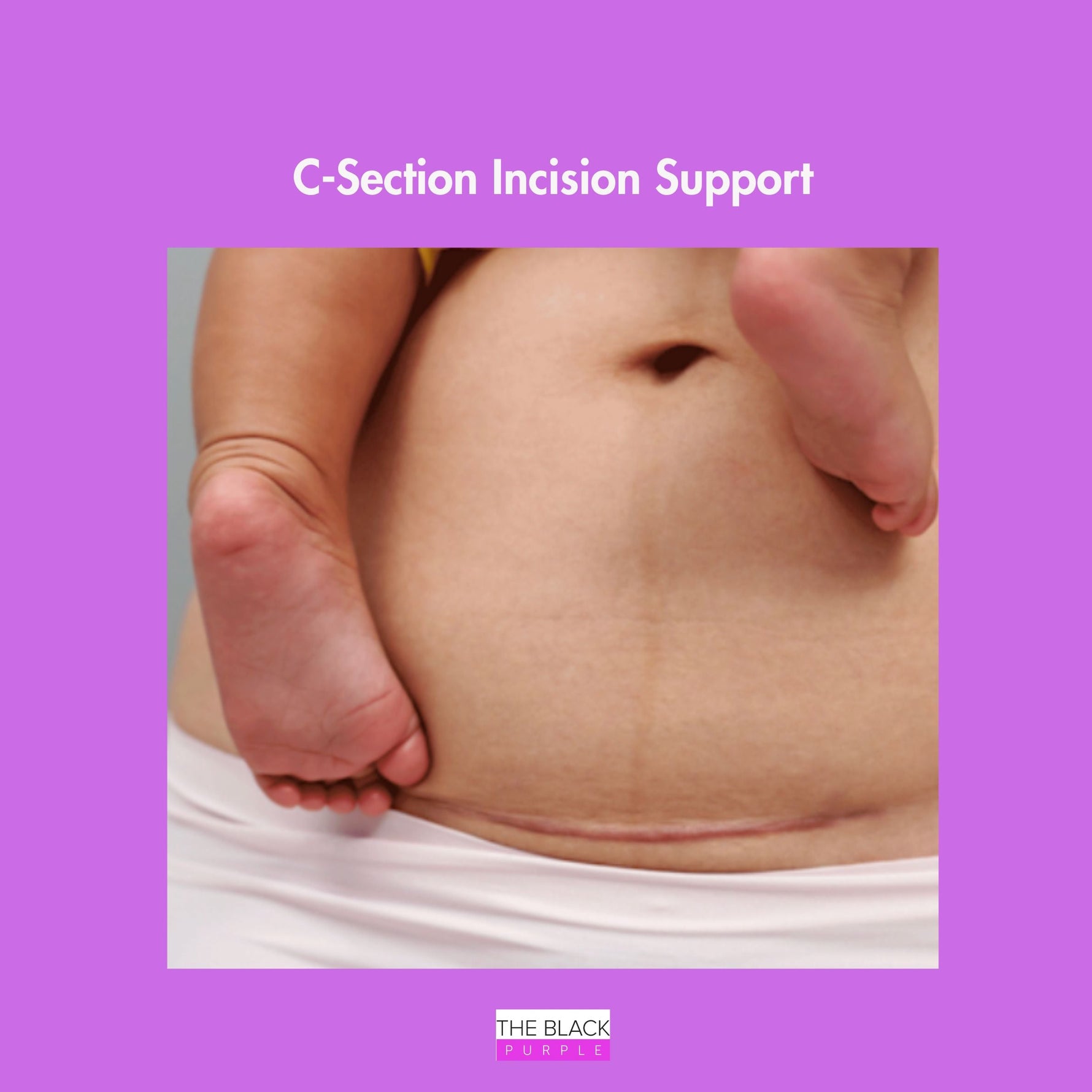 Close-up of abdomen showing postpartum C-section incision area where gentle compression support may aid recovery.