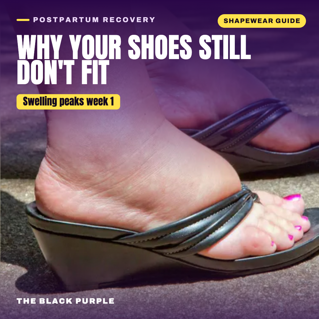 Postpartum swelling and fluid retention — swollen foot in sandal; how shapewear compression helps
